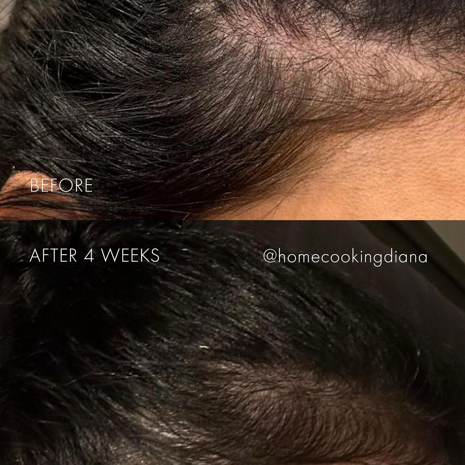 Sweed - the Hair Serum (6 Ml | 0.2 Fl Oz) | Nutrient-Rich, Non-Greasy Formula | Easy Roll-On Applicator | Keratin, Biotin, Peptides