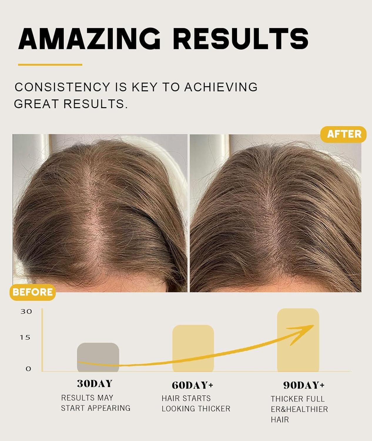 Batana Oil for Hair Growth, 100% Natural Pure Batana Oil Paste from Dr. Sebi Honduras, Prevents Hair Loss, Enhances Thickness, Organic Raw Scalp Mask for Women & Men (4.05 Oz)